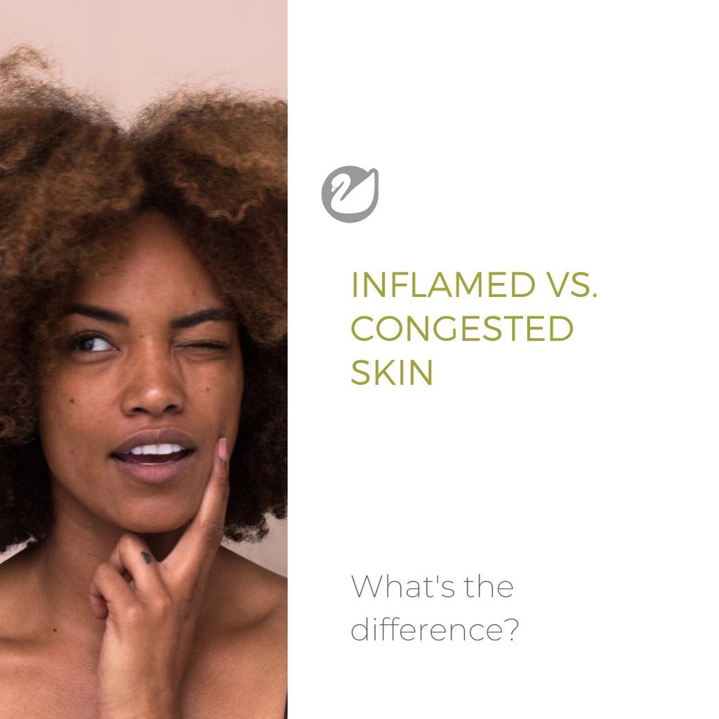 Choosing Skincare for Congested Skin