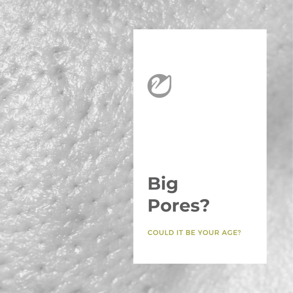 Can Age make my Pores Bigger?