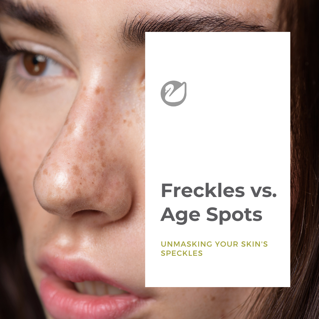 Freckles vs. Age Spots: Unmasking Your Skin's Speckles
