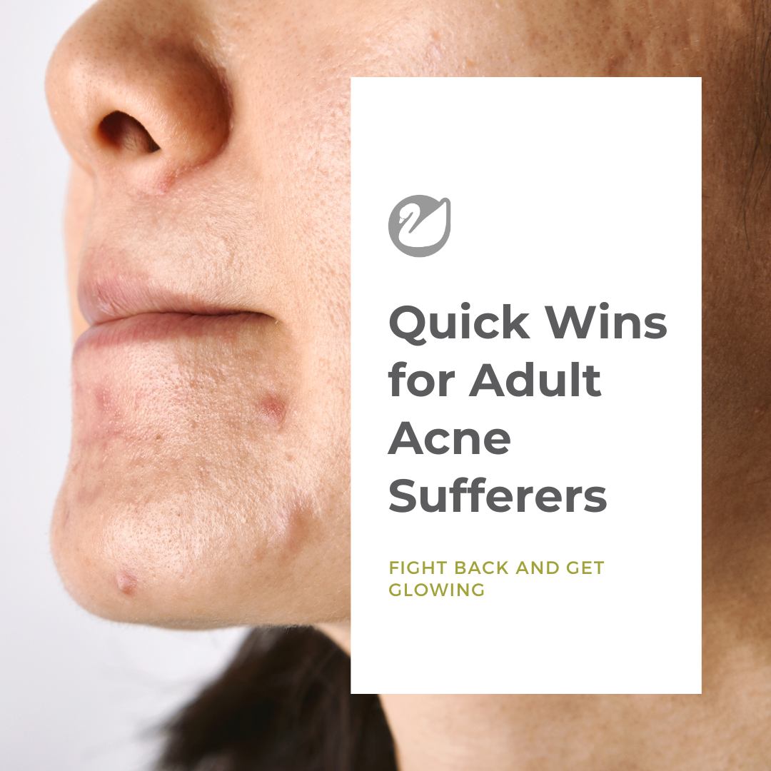 Quick Wins for Adult Acne Sufferers: Fight Back and Get Glowing