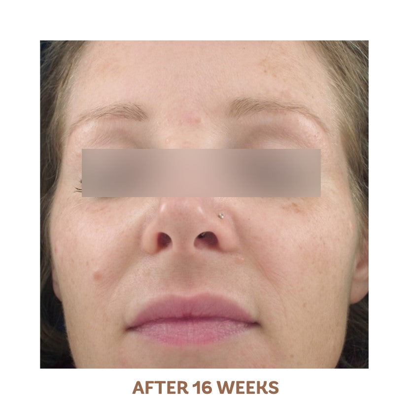Radiance Serum