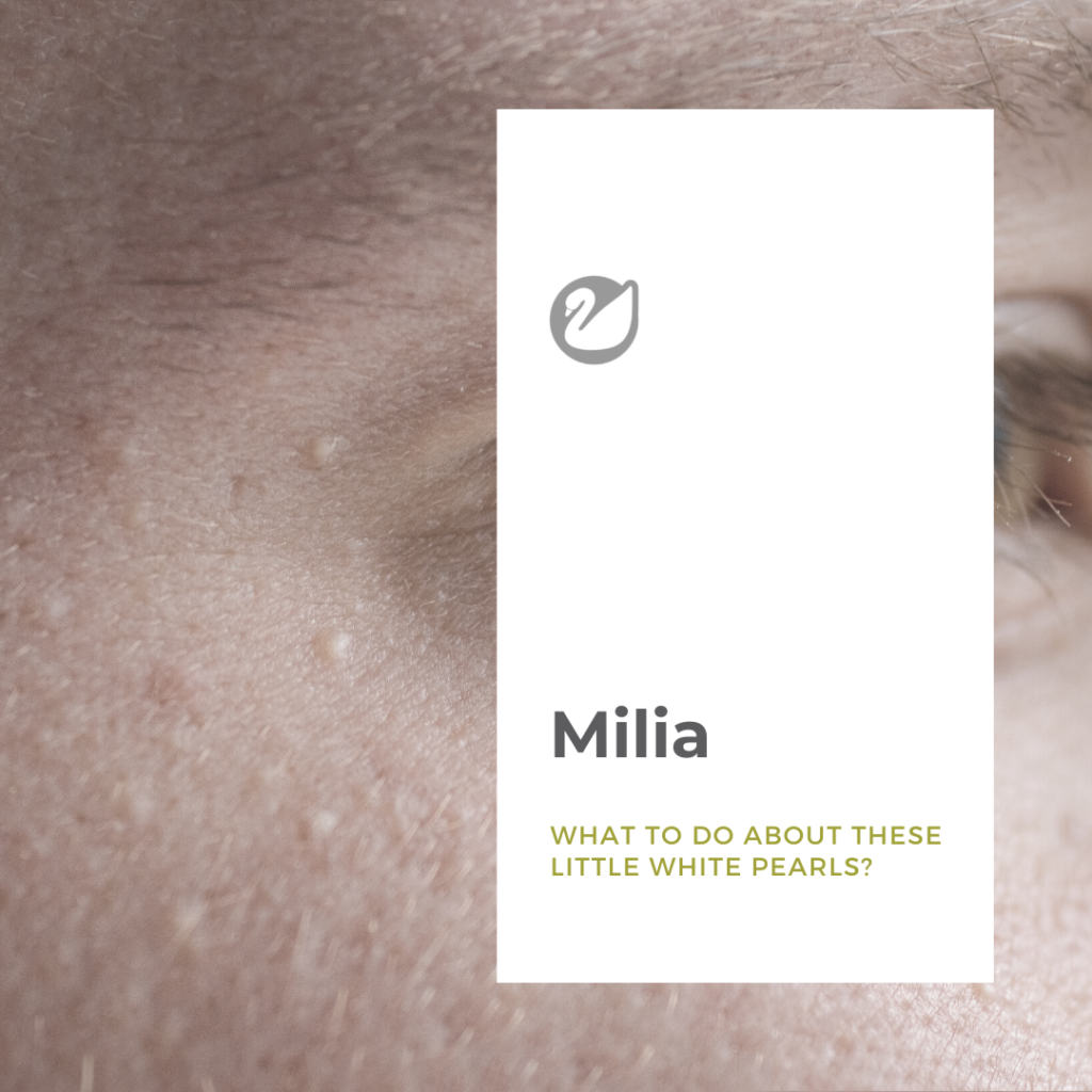 Skin concern : Milia