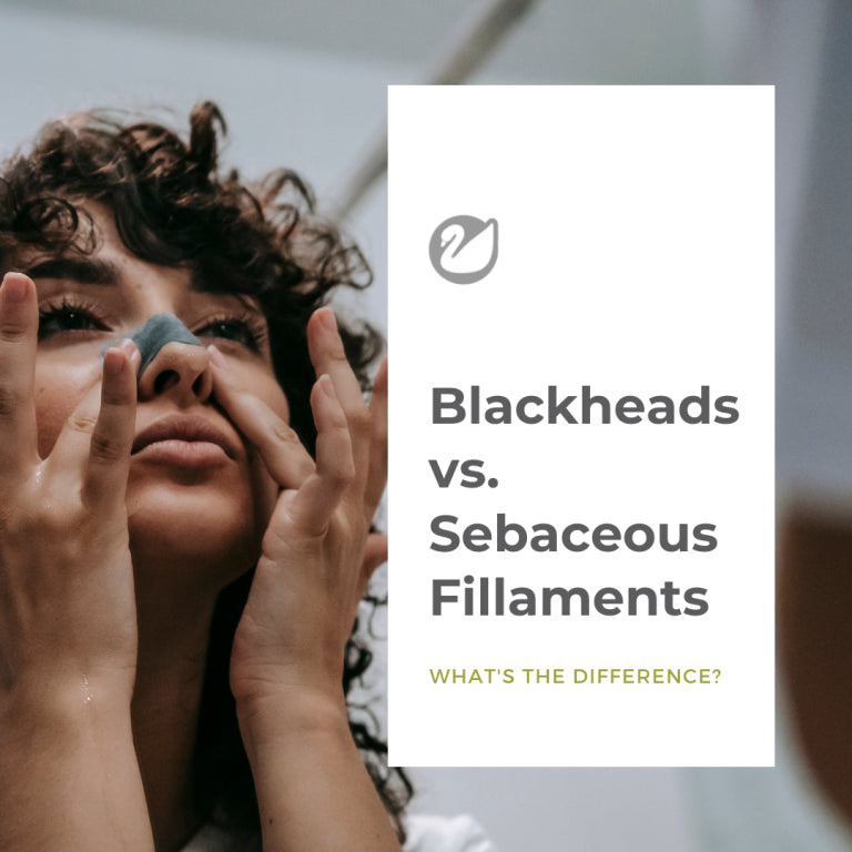 Blackheads vs Sebaceous Fillaments